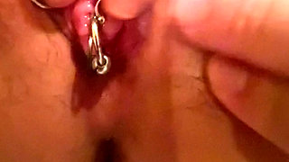 insertion urethral opening pops out