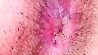 Stinky Hairy Asshole up Close