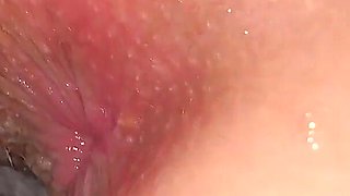 She Danced All Naght and Her Butthole Area Turned Red. I Need to Moisturise and Treat It with My Tongue.