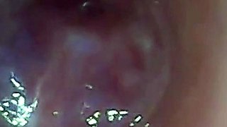 Endoscope POV: Test Tube Cock Urethral Insertion