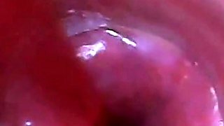test tube cock endoscope POV urethral insertion ball rod