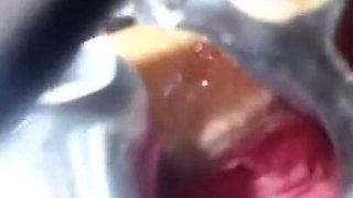 Speculum Cervix & Anal Exam Great View Inside