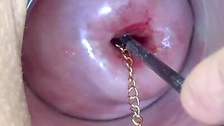 Extreme cervix playing with insertion metal chain in uterus