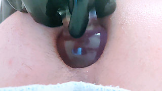Erika Oak Big Gape After A Big Plug