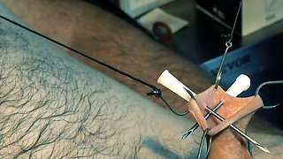 An Artful Study in Needles and Steel