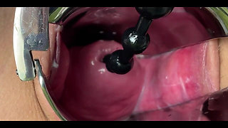 Close up Gyno Masturbation