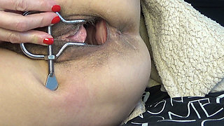 New Video Featuring a Vaginal Dilator