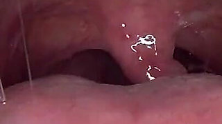 Swallowing Lots of Gummi Bears at Same Time!!