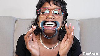 Youronlyphoenix Dental Retractor Mouth Tour