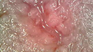 Medical Endoscope Oral Exam: Gummy Chewing, Extreme Teeth & Tongue Macro