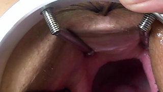 More Fisting, Double and Speculum. Full