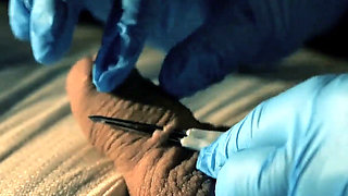 Medical Play Fun, Mummification, Needle CBT and Electro